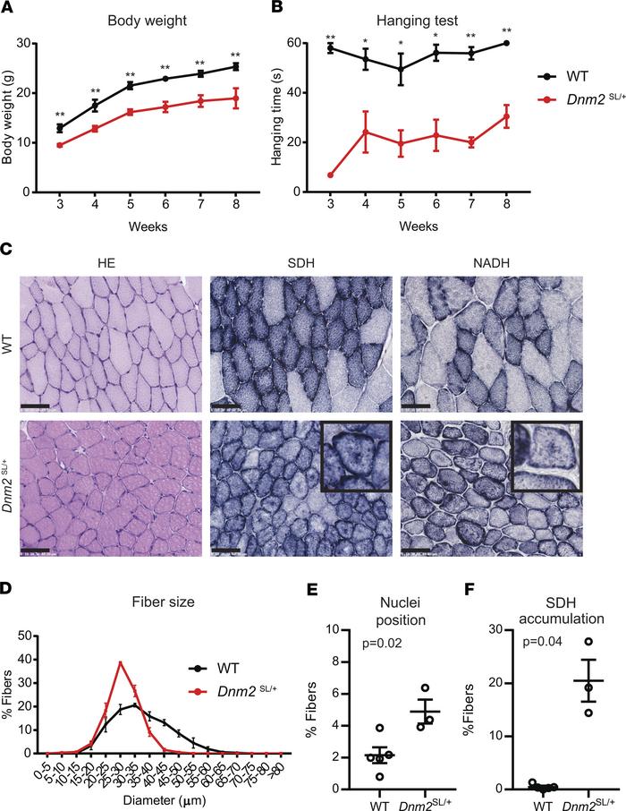 
Dnm2SL/+ develop a severe muscle phenotype resembling centronuclear myo...
