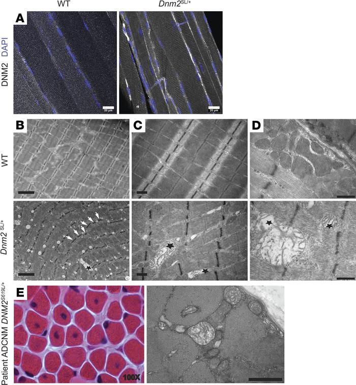 Abnormal mitochondria structure in the Dnm2SL/+ mice.
(A) Subcellular lo...
