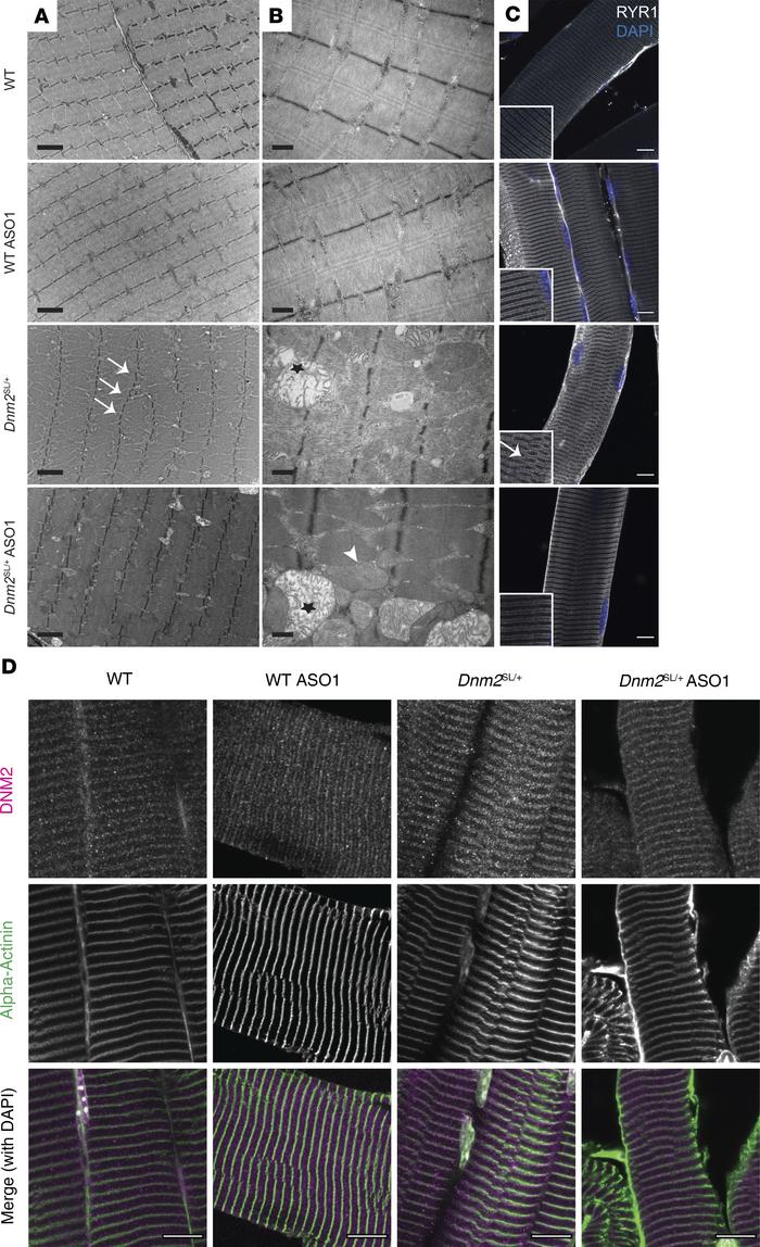 Ultrastructural analysis of Dnm2SL/+ muscles upon DNM2 reduction.
(A) Ul...