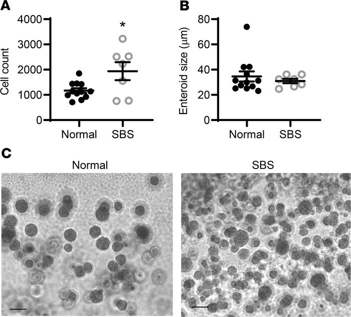 Stem cell expansion in small intestine from patients with SBS.
Stem cell...