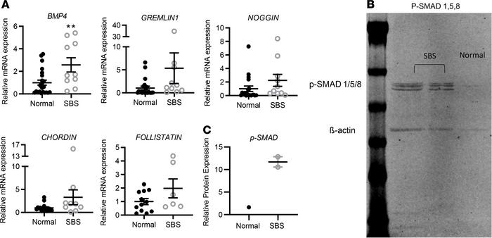 BMP signaling pathway mRNA expression in SBS versus normal small bowel b...