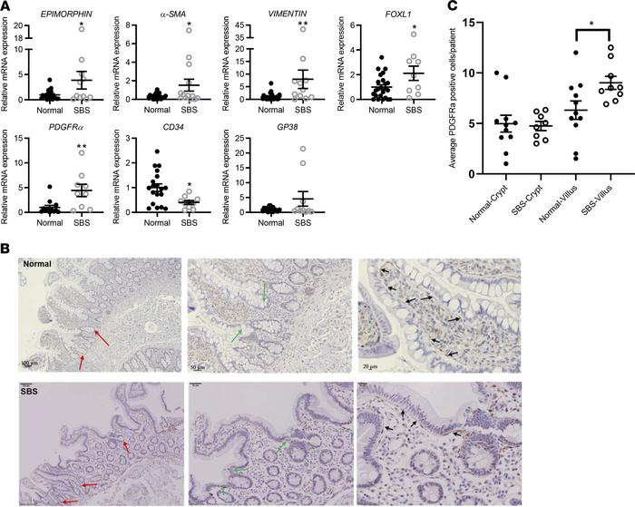Mesenchymal cell marker gene expression analyses.
Stem cell niche mesenc...