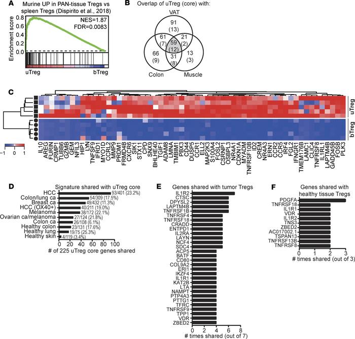 uTregs share their transcriptional signature with tissue- and tumor-infi...