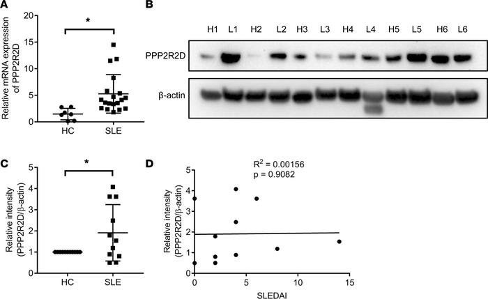 PPP2R2D expression is increased in T cells from patients with SLE.
(A) T...