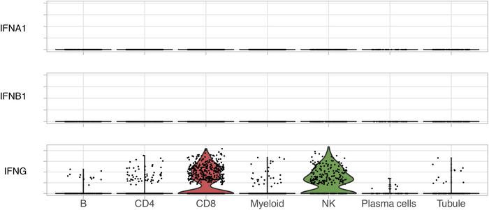 Type 2 IFN (IFN-γ), but not type 1 (IFN-α or IFN-β), is expressed in lup...