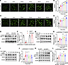 EP4 promotes NO production via enhancing eNOS phosphorylation at Ser1177 in