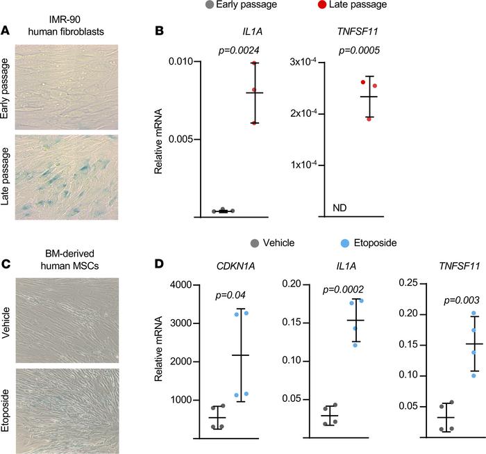 Senescence stimulates RANKL production in human cells.
(A) Representativ...
