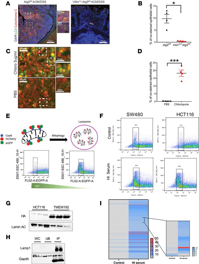 CRC cells employ mitophagy under nutrient stress.
(A and B) Representati...