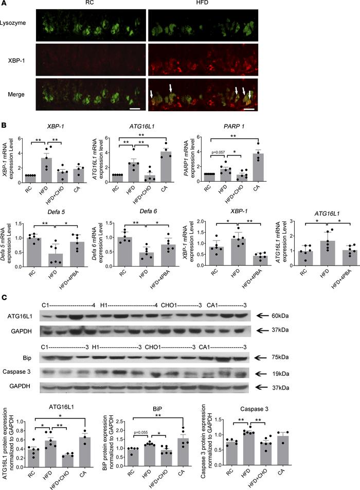 HFD induces protein and gene expression of ER stress, autophagy, and DNA...
