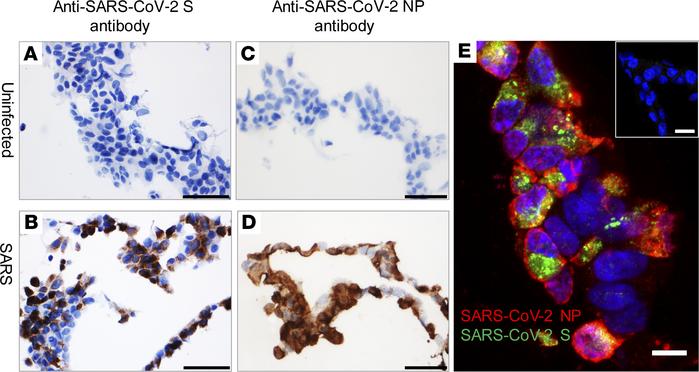 Detection of SARS-CoV-2 antigens by IHC and IFA in FFPE cell pellets.
(A...