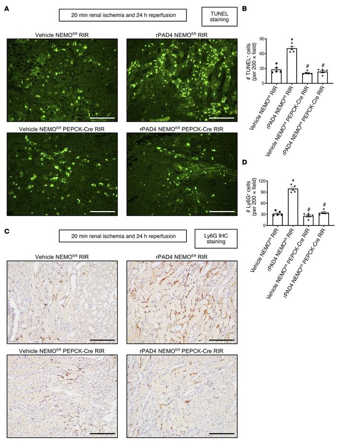 PAD4 exacerbates ischemic AKI-induced renal tubular apoptosis and neutro...