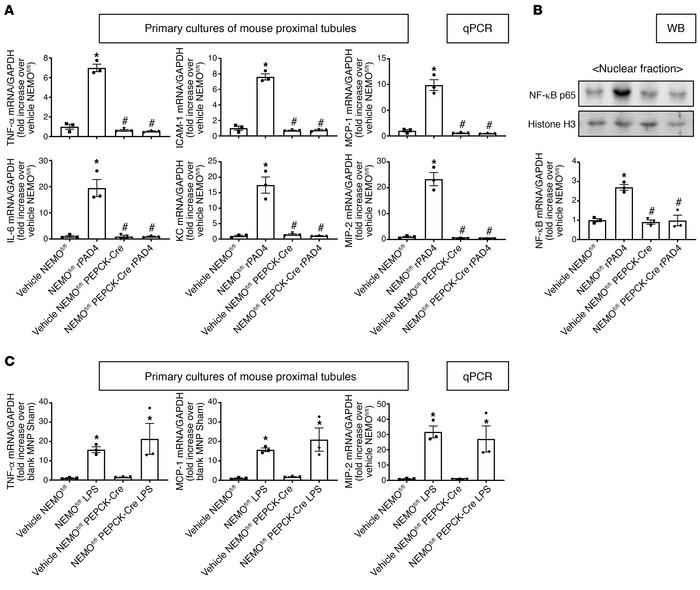 NEMO-mediated induction of renal proximal tubular NF-κB proinflammatory ...