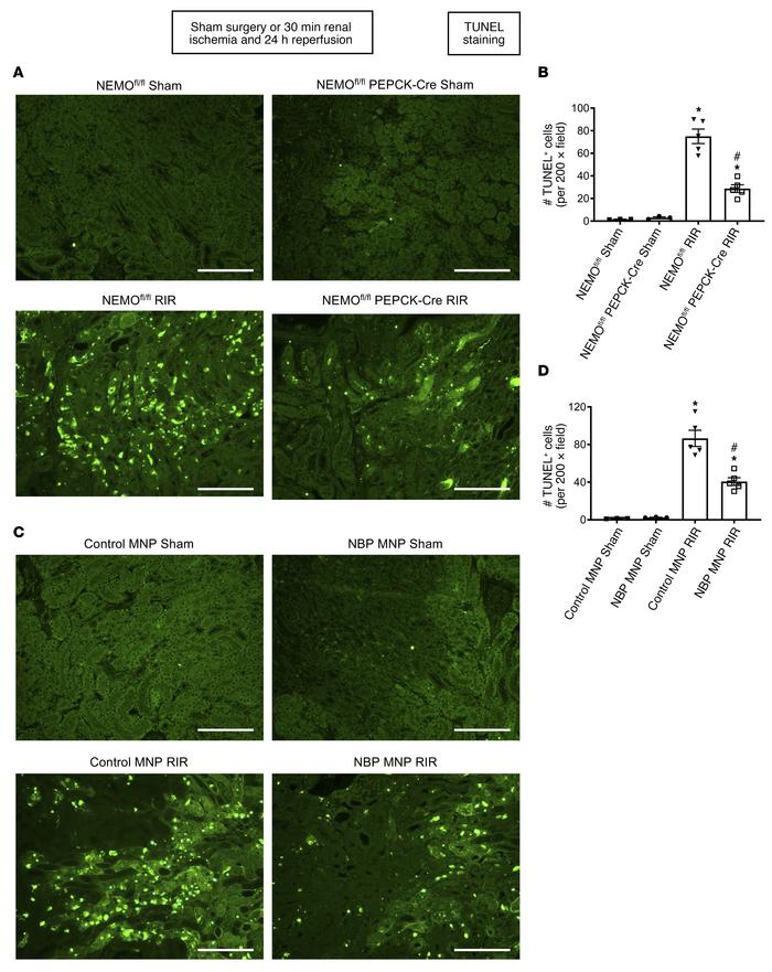 Kidney PT NEMO deletion or selective tubular delivery of NBP MNP attenua...