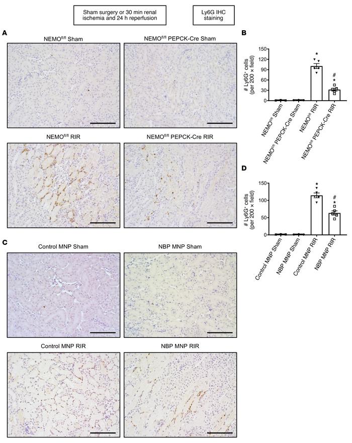 Kidney PT NEMO deletion or selective tubular delivery of NBP MNP decreas...