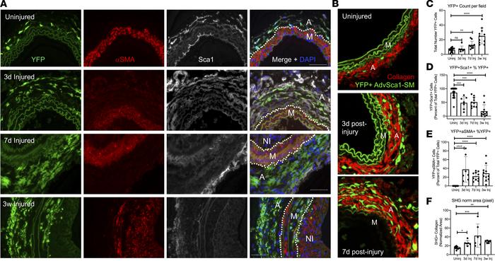 AdvSca1-SM cells contribute to injury-induced adventitial remodeling.
Gl...
