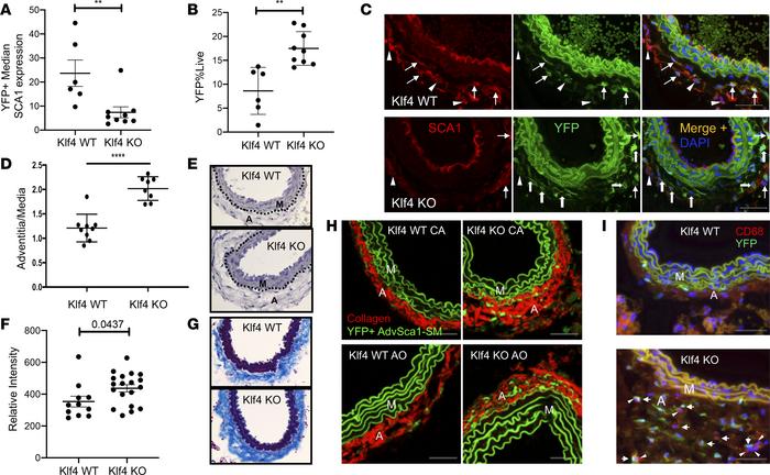 AdvSca1-SM cell–specific deletion of KLF4 promotes spontaneous adventiti...