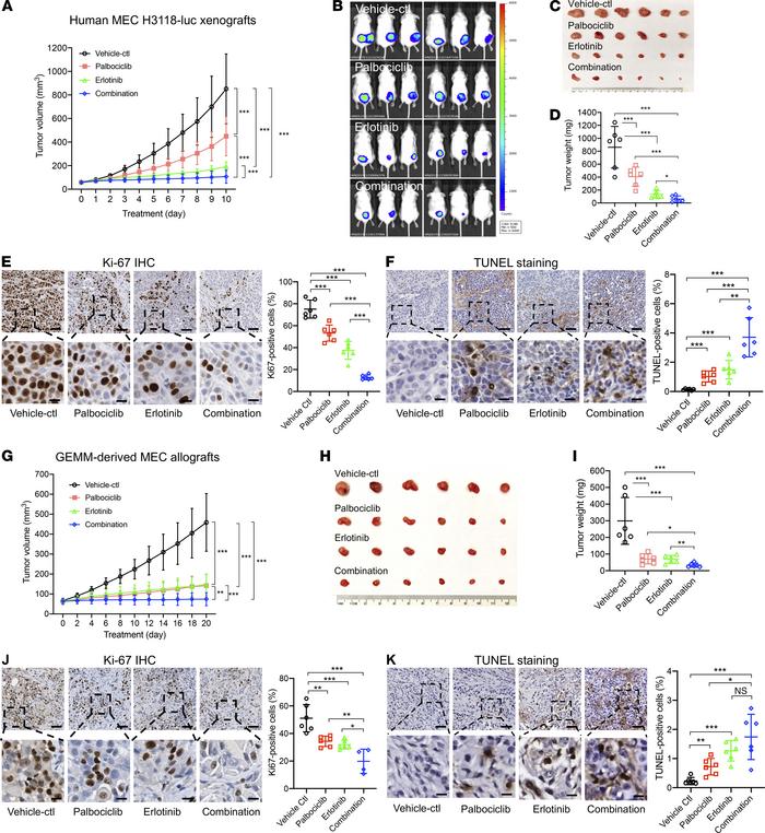 Concurrent CDK4/6 and EGFR inhibition showed enhanced antitumor effect i...