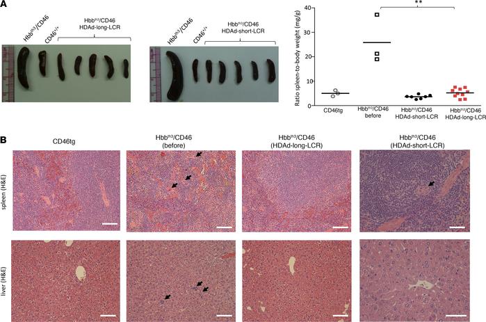 Phenotypic correction of extramedullary hematopoiesis in spleen and live...