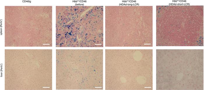 Phenotypic correction of hemosiderosis in spleen and liver (week 16).
Ir...