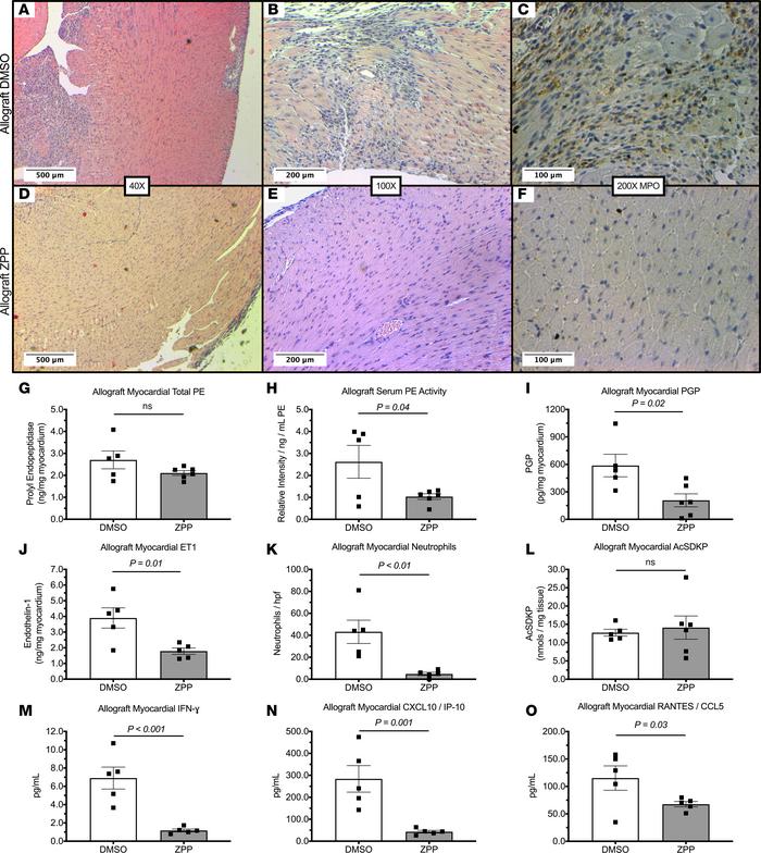 PE inhibition attenuates allograft inflammatory response.
Allograft mice...