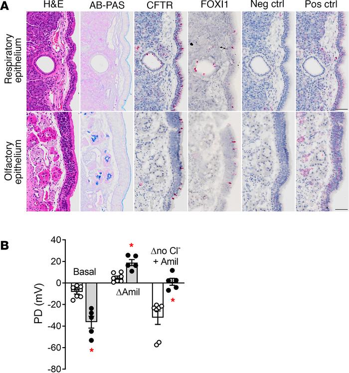 Characterization of CFTR expression and function in the rabbit nasal cav...