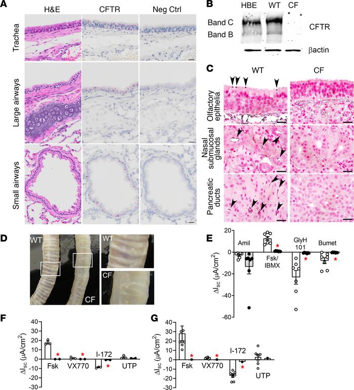 Characterization of rabbit CFTR expression and function in the lower air...
