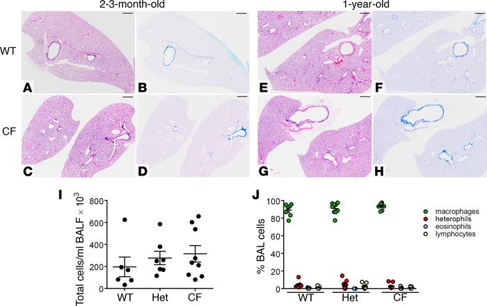Characterization of lung phenotype in CF rabbits.
(A–H) Representative m...