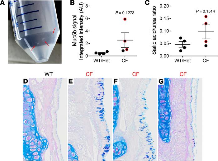 Subtle alterations in lung phenotypes in a fraction of surviving CF rabb...