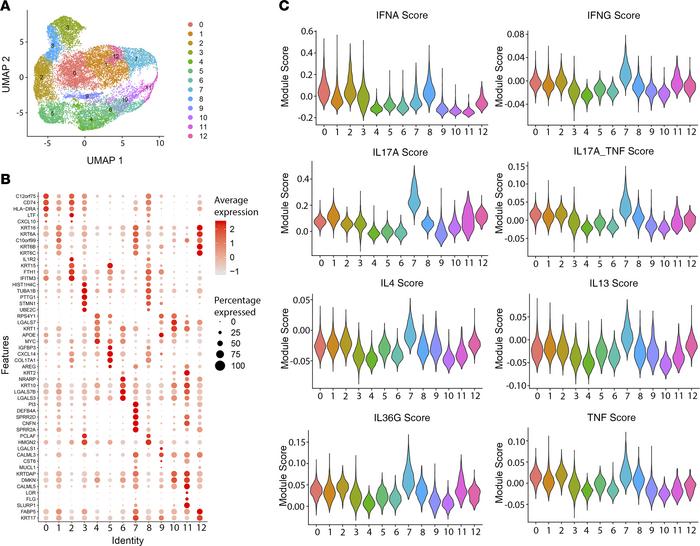 Inflammatory responses in HS keratinocytes have elevated type II IL-17, ...