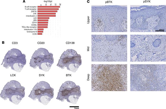 Enrichment and activation of B cell–associated signaling pathways in HS ...