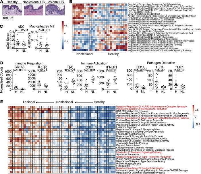 Nonlesional skin in HS has defects in immune regulatory pathways.
(A) Re...