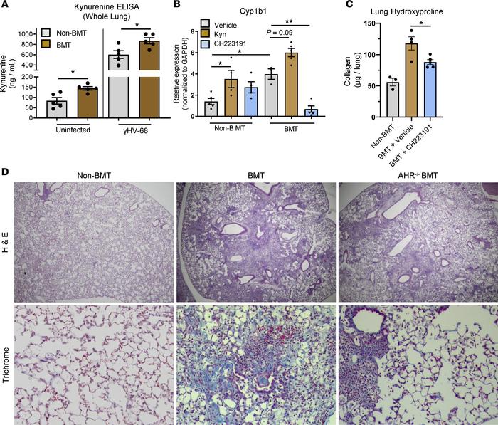 Ablation of AHR signaling rescues γHV-68–induced fibrosis following BMT....