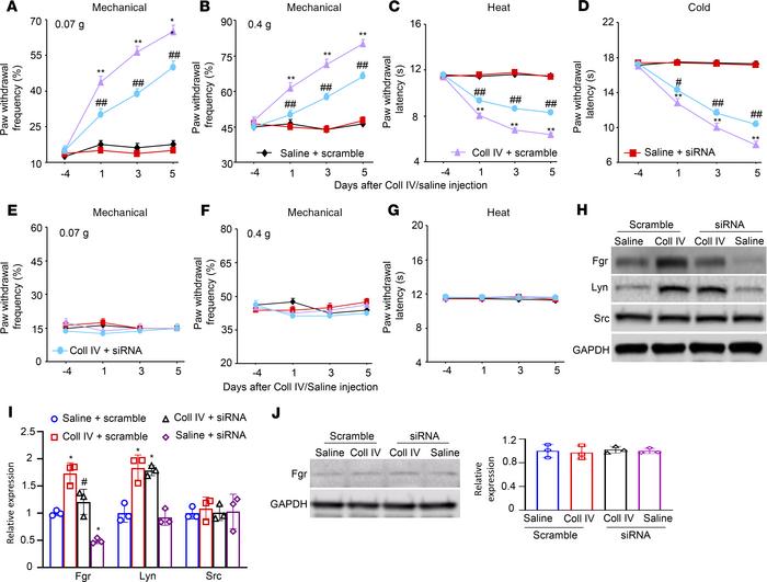Effect of thalamic microinjection of Fgr siRNA on Coll IV microinjection...