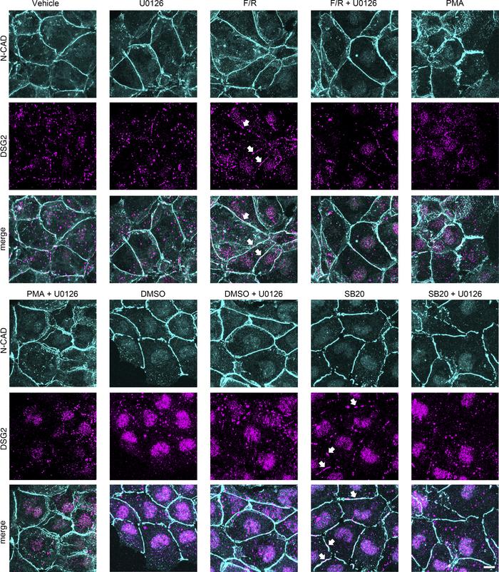 ERK1/2 inhibition caused alteration of DSG2 localization.
Immunostaining...