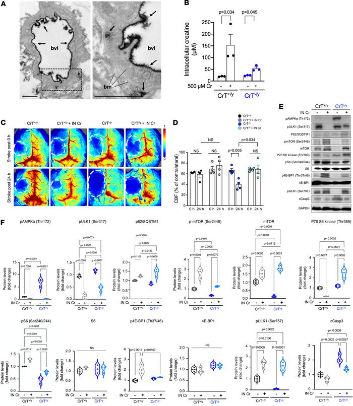 Post-stroke intranasal Cr delivery reduces brain injury and signaling im...