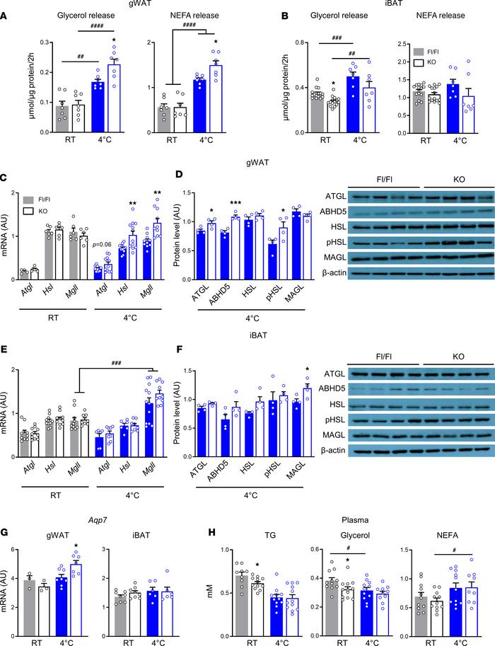 Increased cold-stimulated activity of the lipolytic arm of the GL/FFA cy...