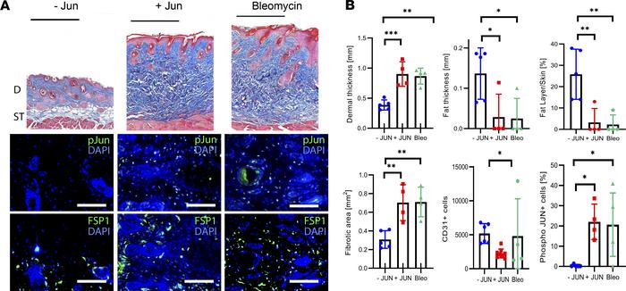 JUN induces skin fibrosis in mice.
(A) Representative trichrome stains a...