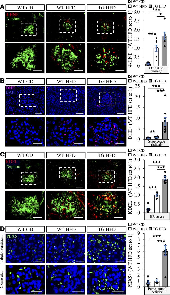 Overexpression of STK25 in high-fat diet–fed mice results in substantial...