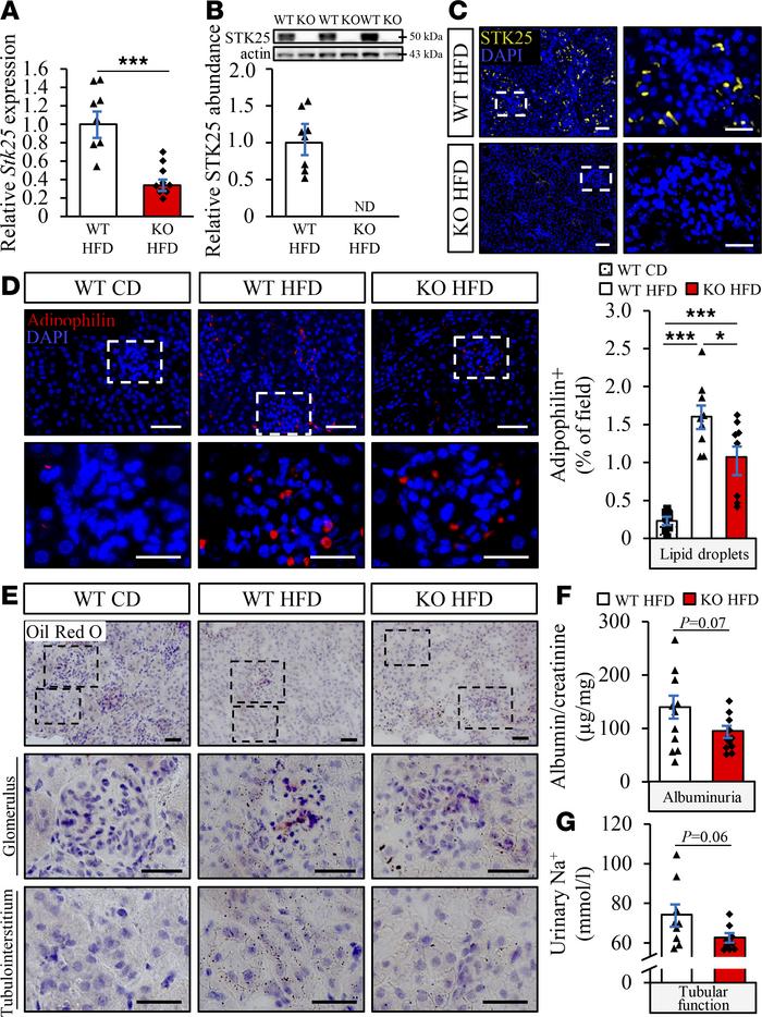 Genetic ablation of STK25 in mice prevents high-fat diet–induced renal l...