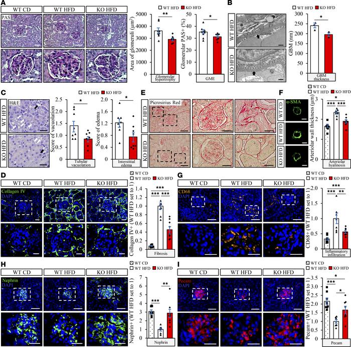 Depletion of STK25 in mice alleviates high-fat diet–induced glomerular m...
