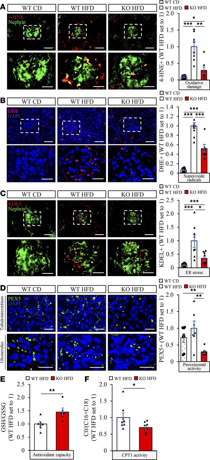 Knockdown of STK25 in high-fat diet–fed mice substantially suppresses re...