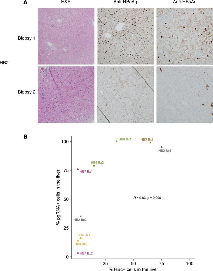 JCI Insight Single hepatocytes show persistence and transcriptional