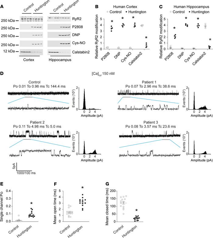 Cortex and hippocampal RyR2 channel remodeling result in the biochemical...
