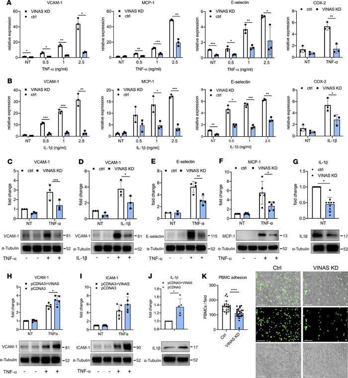 
VINAS regulates inflammatory markers in endothelial cells.
VINAS knockd...