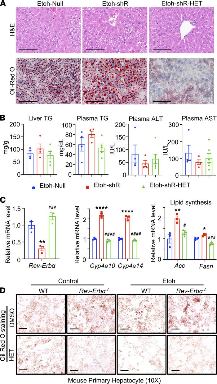 CYP4A antagonist HET0016 attenuated Rev-Erbα deficiency enhanced lipid a...