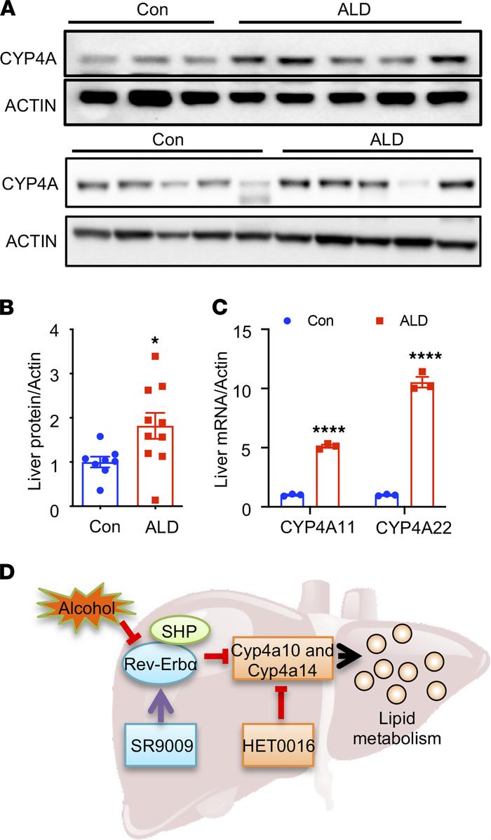 CYP4A was induced in human alcoholic liver cirrhosis.
(A) Western blot a...