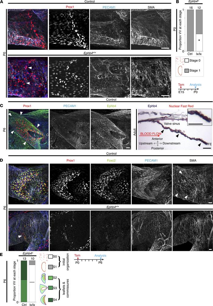 EphB4 is expressed on E18 and P0 and is required for normal VFC organiza...