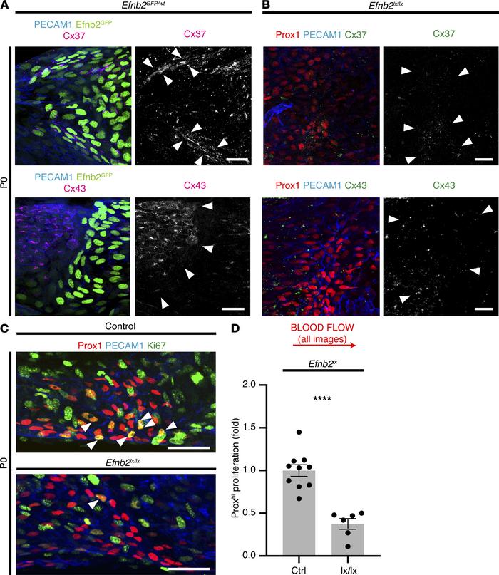 
Efnb2 deletion disrupts gap junction protein expression pattern and pro...