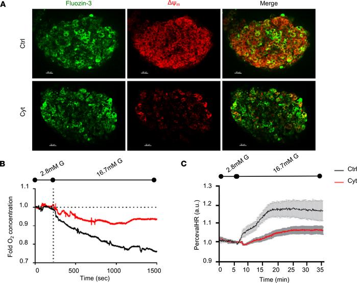 Proinflammatory cytokines impair mitochondrial bioenergetics in human is...