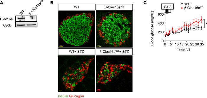 Mitophagy deficiency aggravates STZ-induced dysglycemia.
(A) Clec16a exp...